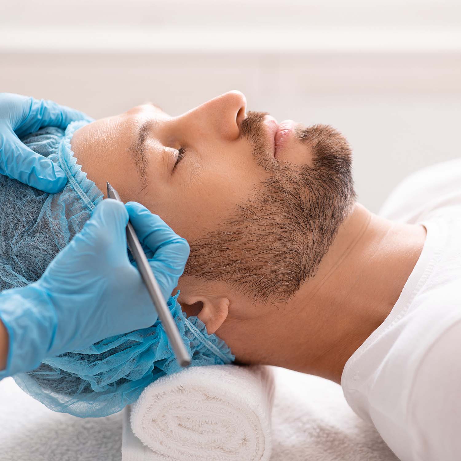 Hair transplant — natural hairline and density