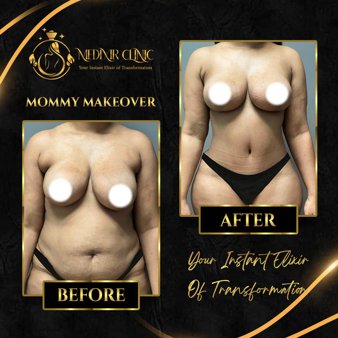 mommy-makeover4.jpg